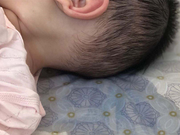 頭部經常出汗什么原因，頭部出汗多怎么調理